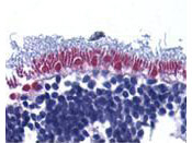 AIF Antibody in Immunohistochemistry (Paraffin) (IHC (P))