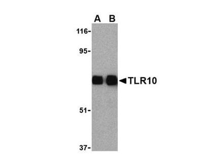 TLR10 Antibody in Western Blot (WB)