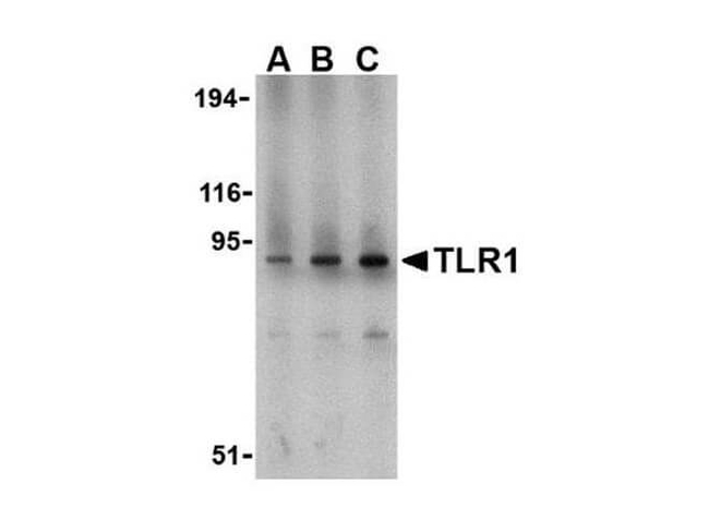 TLR1 Antibody in Western Blot (WB)