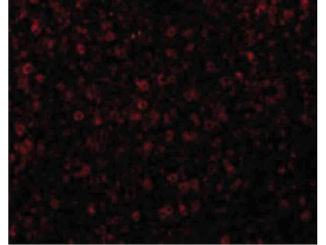 CCR3 Antibody in Immunocytochemistry (ICC/IF)