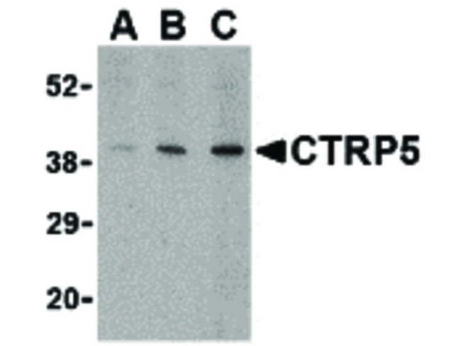 CTRP5 Antibody in Western Blot (WB)