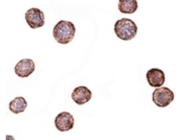 CXCR4-Lo Antibody in Immunocytochemistry (ICC/IF)