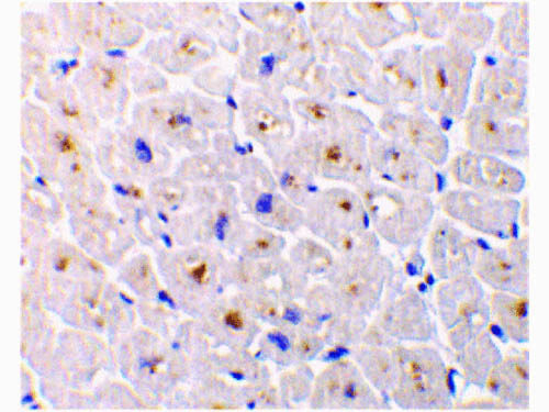 DcR3 Antibody in Immunohistochemistry (Paraffin) (IHC (P))