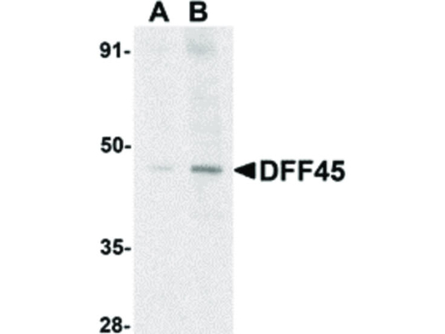 DFF45 Antibody in Western Blot (WB)