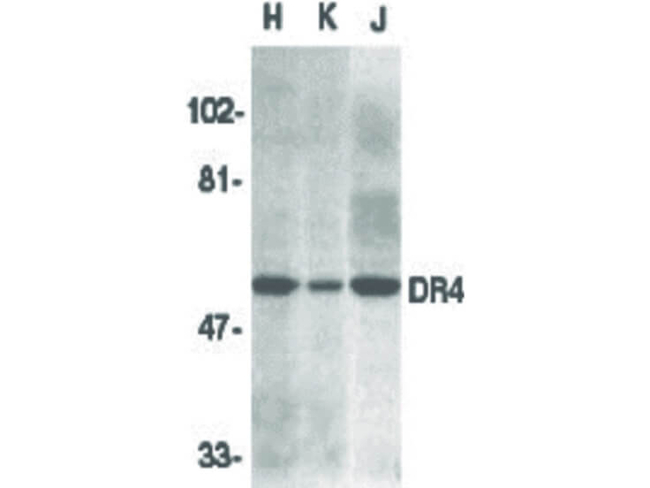 DR4 Antibody in Western Blot (WB)
