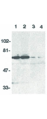 DR6 Antibody in Western Blot (WB)