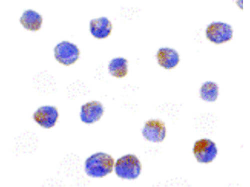 DRAK2 Antibody in Immunocytochemistry (ICC/IF)