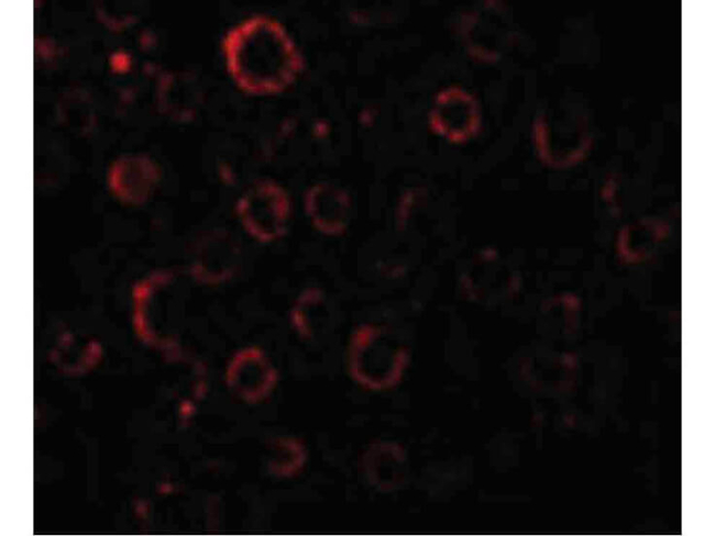 MADD Antibody in Immunocytochemistry (ICC/IF)