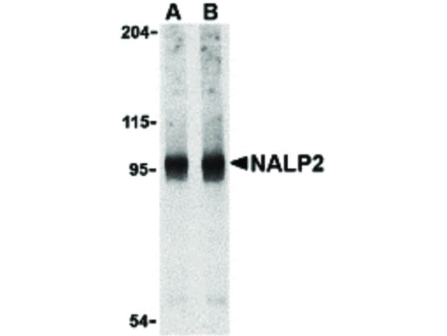 NALP2 Antibody in Western Blot (WB)