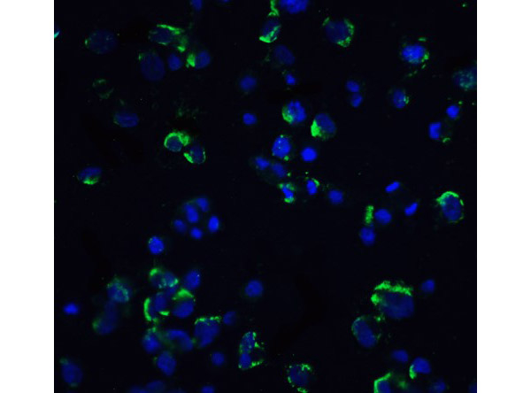 NIK Antibody in Immunocytochemistry (ICC/IF)