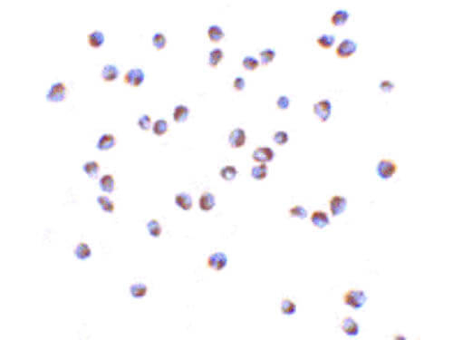 NOD2 Antibody in Immunocytochemistry (ICC/IF)