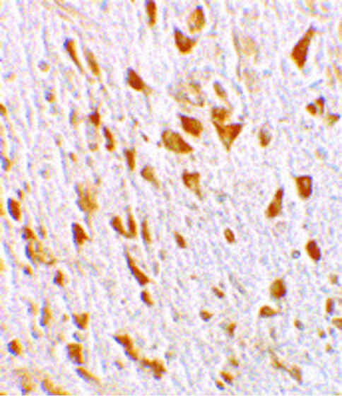 PIKE Antibody in Immunohistochemistry (Paraffin) (IHC (P))