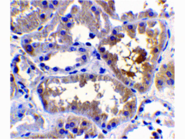 RAIDD Antibody in Immunohistochemistry (Paraffin) (IHC (P))