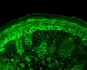CPN10 Antibody in Immunocytochemistry (ICC/IF)