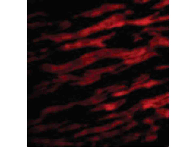TIRAP Antibody in Immunocytochemistry (ICC/IF)