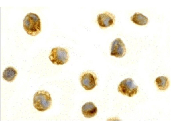 BAFF Antibody in Immunocytochemistry (ICC/IF)