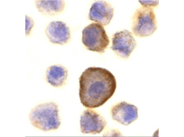 PERP Antibody in Immunocytochemistry (ICC/IF)