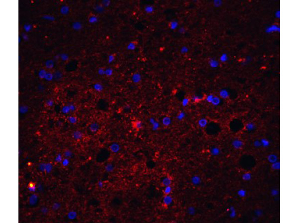 Trail Antibody in Immunocytochemistry (ICC/IF)