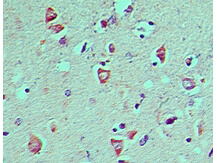 ATG8 Antibody in Immunohistochemistry (Paraffin) (IHC (P))