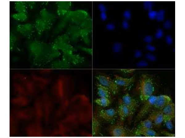 DR5 Antibody in Immunocytochemistry (ICC/IF)