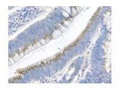 Gremlin Antibody in Immunohistochemistry (Paraffin) (IHC (P))