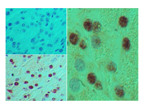 HB9 Antibody in Immunohistochemistry (Paraffin) (IHC (P))