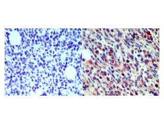 Langerin Antibody in Immunohistochemistry (Paraffin) (IHC (P))