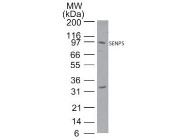 SENP5 Antibody in Western Blot (WB)