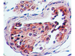 Serotonin Receptor 3A Antibody in Immunohistochemistry (Paraffin) (IHC (P))