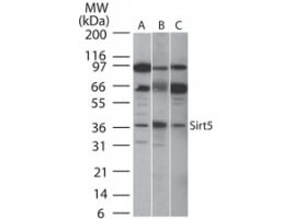 SIRT5 Antibody in Western Blot (WB)