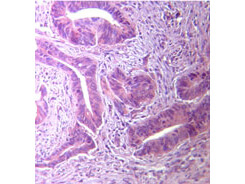 TLR5 Antibody in Immunohistochemistry (Paraffin) (IHC (P))