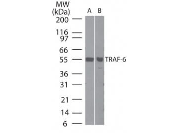 TRAF6 Antibody in Western Blot (WB)