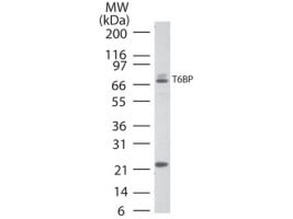 TRAF6 Binding Protein Antibody in Western Blot (WB)