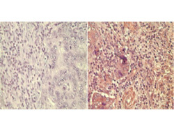 Wnt5A Antibody in Immunohistochemistry (Paraffin) (IHC (P))