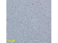 WNVM Antibody in Immunohistochemistry (Paraffin) (IHC (P))