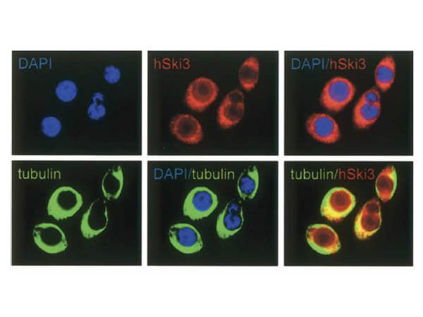 SKI3 Antibody in Immunocytochemistry (ICC/IF)
