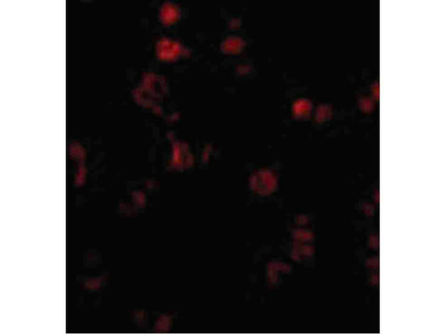 AATF Antibody in Immunocytochemistry (ICC/IF)