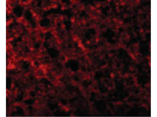 ATR Antibody in Immunocytochemistry (ICC/IF)