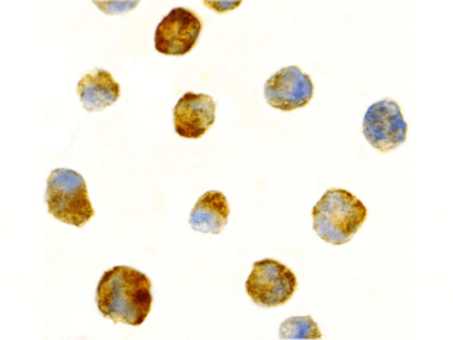 ATR Antibody in Immunocytochemistry (ICC/IF)