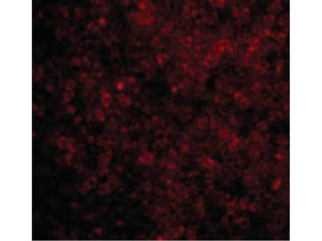 BAD Antibody in Immunocytochemistry (ICC/IF)