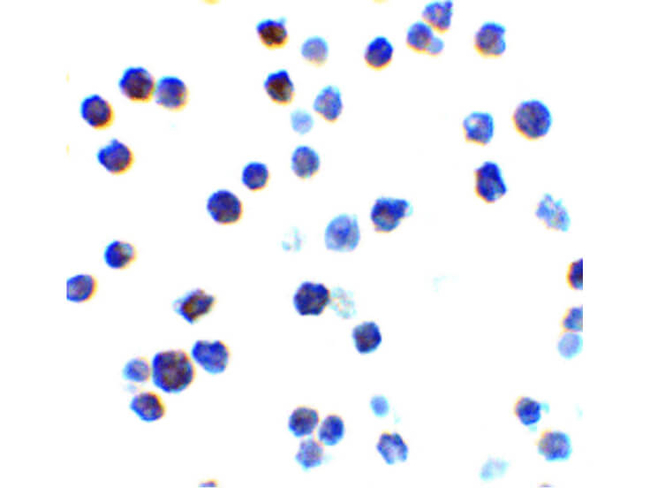 BAK Antibody in Immunocytochemistry (ICC/IF)