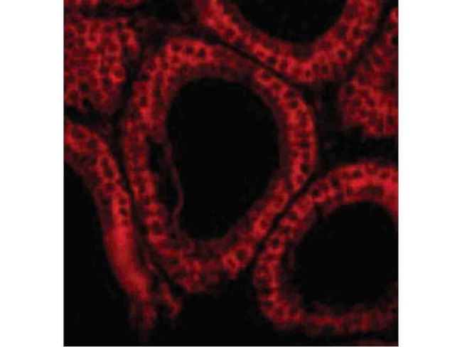 BCL-G Antibody in Immunocytochemistry (ICC/IF)