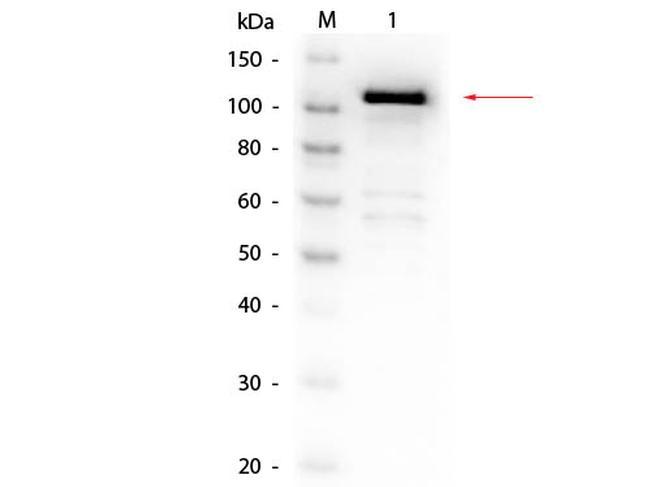 beta Galactosidase Antibody in Western Blot (WB)