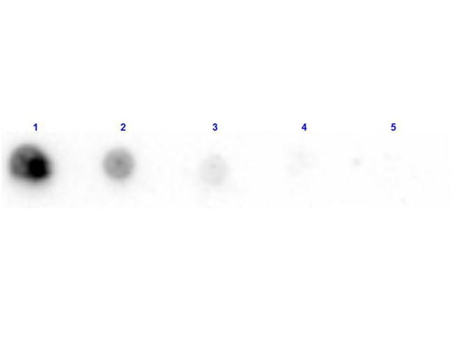 Penicillinase Antibody in Dot Blot (DB)