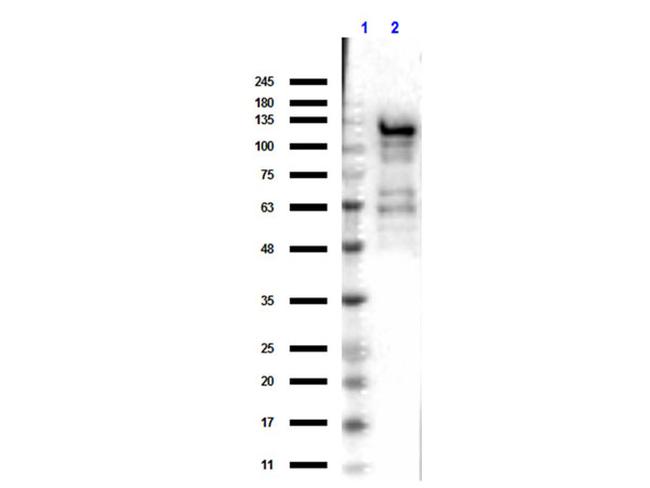 beta Galactosidase Antibody in Western Blot (WB)