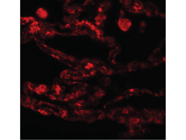 CCDC69 Antibody in Immunocytochemistry (ICC/IF)