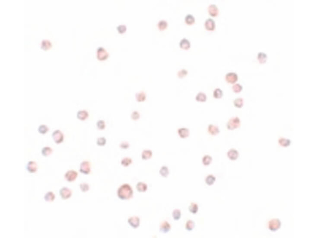 ENC-2 Antibody in Immunocytochemistry (ICC/IF)