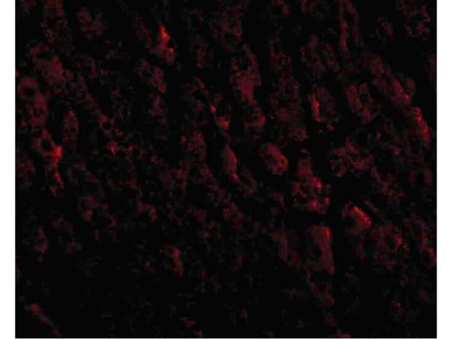 erbB-2 Antibody in Immunocytochemistry (ICC/IF)