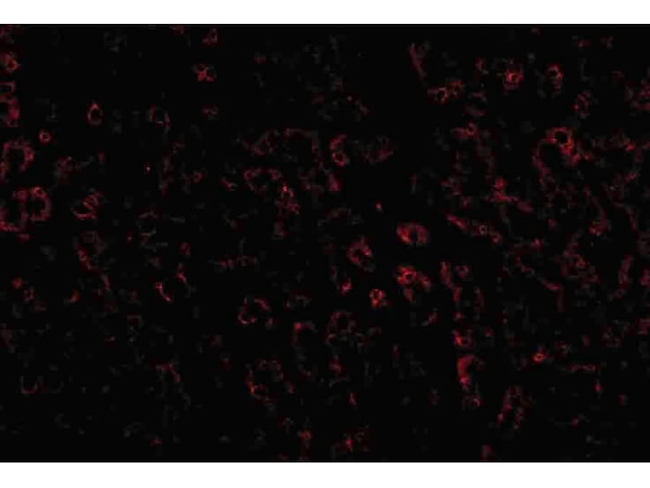 LDL-R Antibody in Immunocytochemistry (ICC/IF)