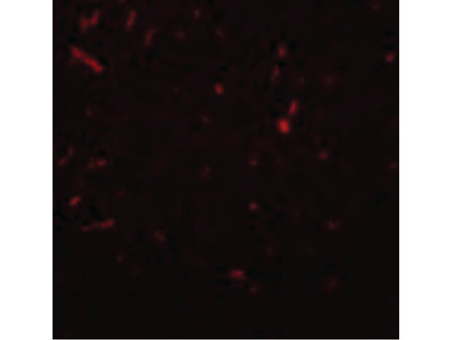 SIRT1 Antibody in Immunocytochemistry (ICC/IF)